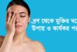 ব্রণ থেকে মুক্তির উপায়।