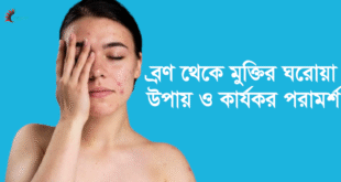 ব্রণ থেকে মুক্তির উপায়।