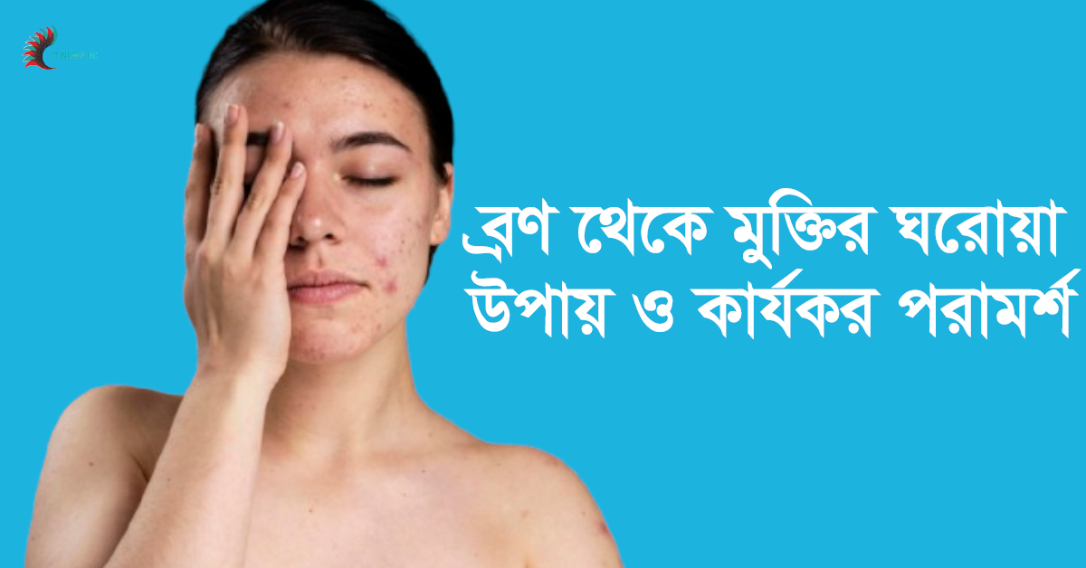 ব্রণ থেকে মুক্তির উপায়।