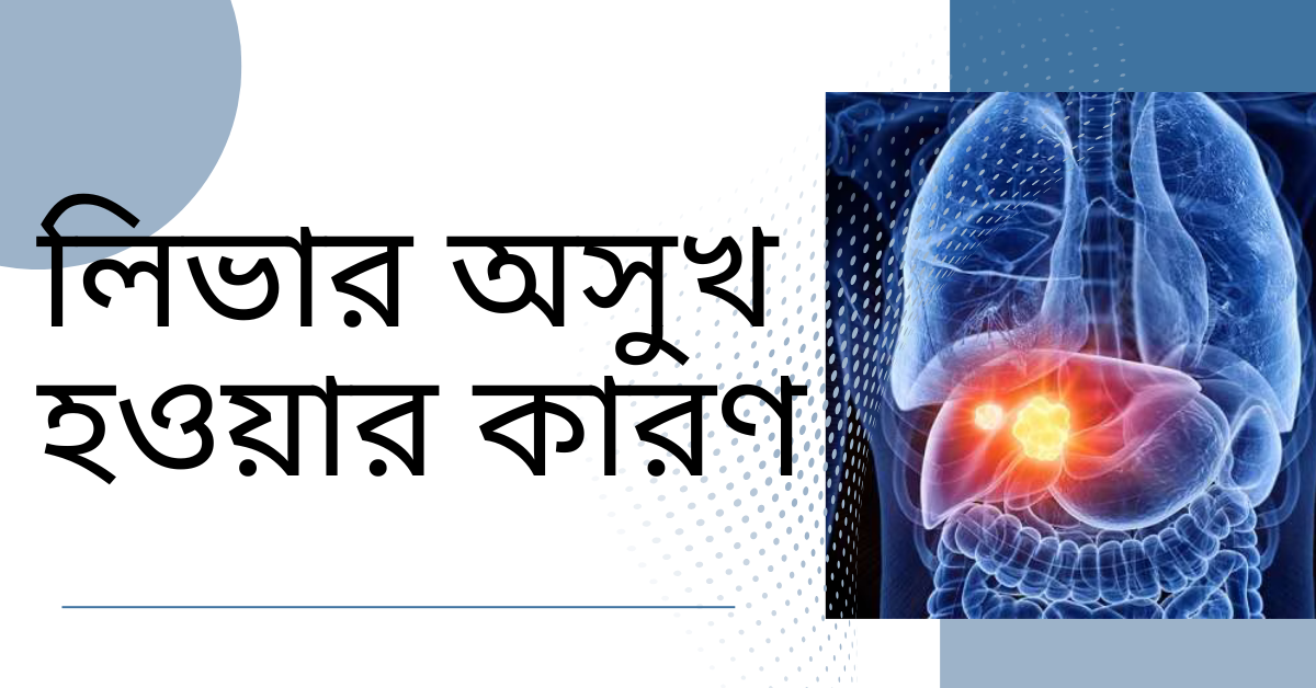 লিভার অসুখ হওয়ার কারণ
